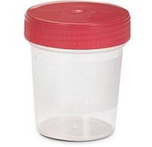 CONTENITORI URINA 150ML STERILI TAPPO A VITE